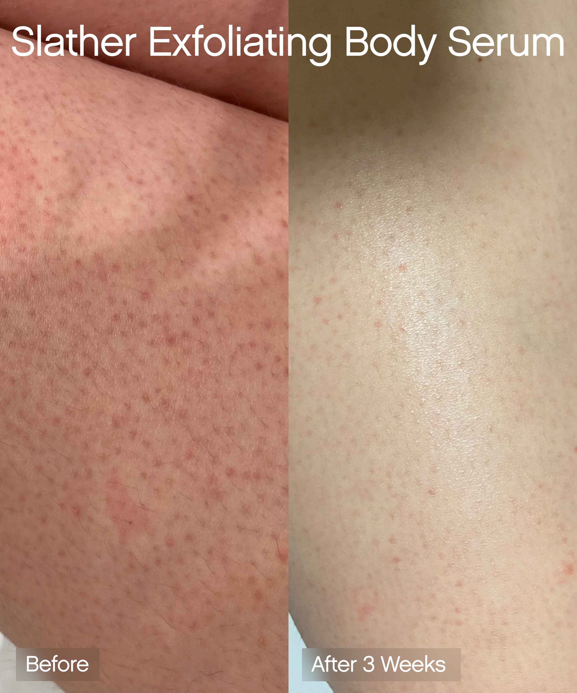 Slather Body Serum